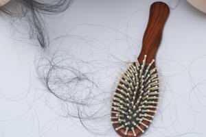 woman hair loss problem