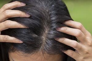 jovem-cabelo-branco-0817-1400x800.jpg