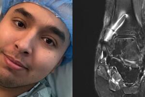 Venezolano desarrolla enfermedad rara tras accidente laboral en Texas que le provoca dolor extremo