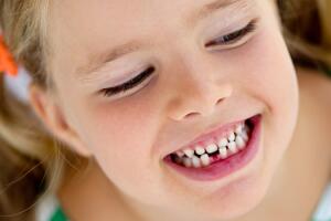 crianca-dentes-sorriso-0716-630x350.jpg