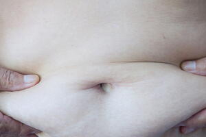 dieta-barriga-e-maos.jpg