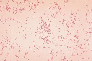 aeromonas_hydrophila.jpg