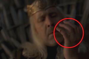 House of the Dragon heridas del rey Viserys herida y dedos (1).jpg