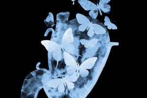 estomago-mariposas.jpg