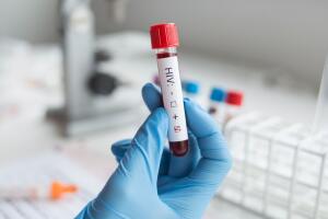 cura-do-HIV.jpg