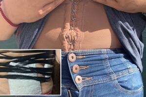 Detienen a una mujer con contrabando de droga en su cuerpo. 