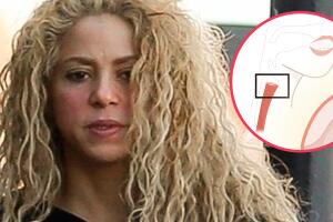 Shakira cuerdas
