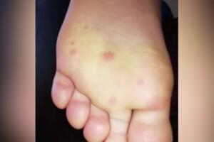 Nuevos síntomas 1.jpg