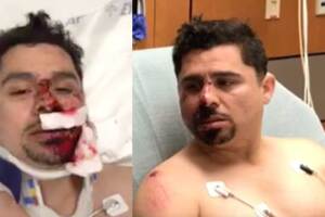 Larry Hernández pierde dientes