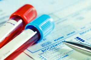 teste-dengue-zika-chikungunya-2.jpg