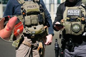 Hombre es acusado de agresión tras morder el dedo de un oficial de ICE en Los Ángeles