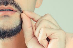 Tricotilomanía / barba