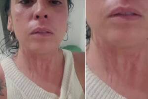 Mayela Laguna mostró las marcas que le dejó el intento de ahorcamiento del que fue víctima