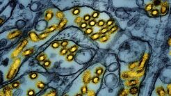 Qué tan peligrosa es la situación de la gripe aviar en California, estado que se declaró en emergencia