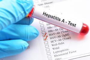 Hepatitis A virus (HAV) test