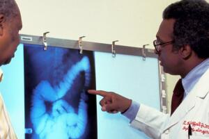 El cáncer de colón uno de los más mortales y se puede prevenir. 