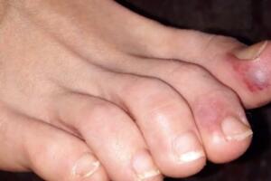 Nuevos síntomas 9.jpg