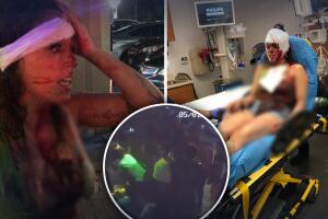 Atacan a hispana en un bar.