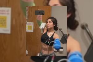 Joven pierde un brazo tras ser atacada en casa por su mascota