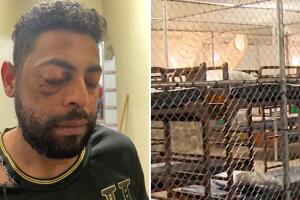 Ever Josué Godoy afirma haber sido golpeado y electrocutado con un Taser por oficiales de ICE.