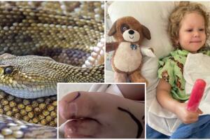 niña es mordida por serpiente de cascabel