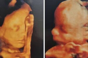 mellizos-claudia-alvarez