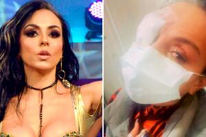 ¿Qué le pasó a Ivonne Montero?: la actriz estalla contra quienes le dicen que se quemó las córneas por "vanidosa"