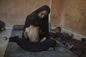 Mideast Wars Dying of Hunger