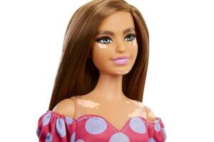 BARBIE_VITILIGO.jpg
