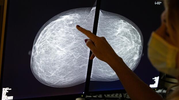 Este efecto secundario de la vacuna contra el coronavirus puede confundirse con cáncer