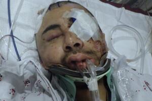 Quién es este hombre Centro Médico General de Los Ángeles pide ayuda para identificarlo