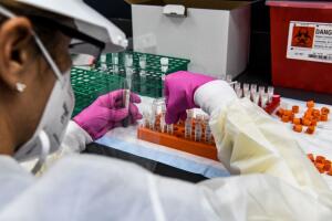 US-HEALTH-VIRUS-VACCINE-TRIALS
