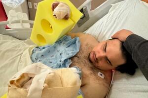 Kevin ahora enfrentará múltiples cirugías reconstructivas.