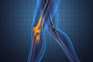 osteoporosis