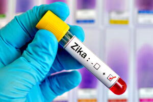 zika-virus-causa-microcefalia-2.jpg