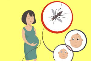 zika-causa-microcefalia.jpg