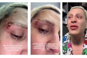 Kunno denunció el ataque en sus redes.