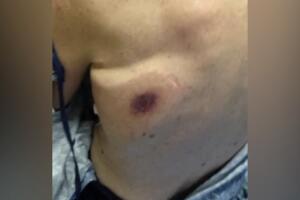 bacteria come carne/IMG_7196.jpg