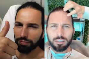 Cirugía de párpados y aplicación de bótox: los arreglitos de Poncho de Nigris.