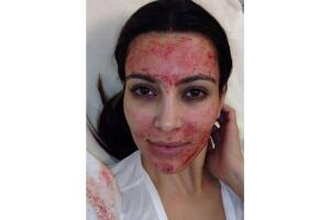 Kim Kardashian facial