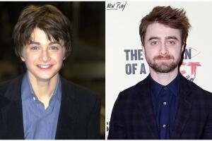 Daniel Radcliffe antes y después Univision.jpg