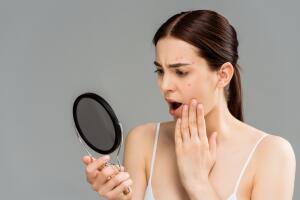 mujer-con-acne-viendose-al-espejo.jpg