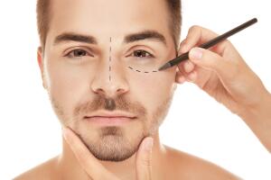 rinoplastia a un hombre
