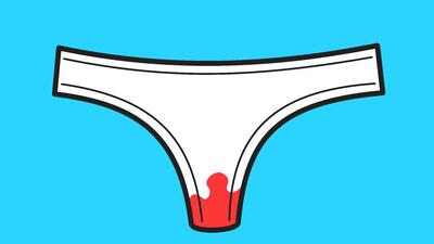 Why does my vagina smell like bleach? 5 types of aromas that you should know Why does my vagina smell like bleach? 5 types of aromas that you should know
