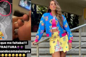 Galilea Montijo mostró las consecuencias de su accidente en Hoy.