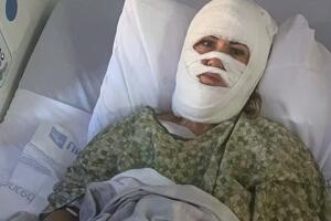 La víctima sufrió quemaduras graves en rostro y cuerpo tras un ataque aparentemente aleatorio y sin robo.