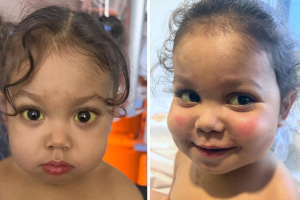 Kawailani-trasplante-hígado-sobrevive-morir