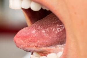 boca-lingua-saliva-0817-1400x800.jpg