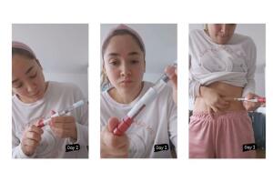 La primera fase de su tratamiento in vitro consta de 28 inyecciones. 14 días después le serán extraídos sus óvulos para fecundarlos.