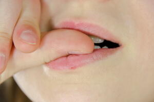 maleficios-de-roer-unhas-2.jpg